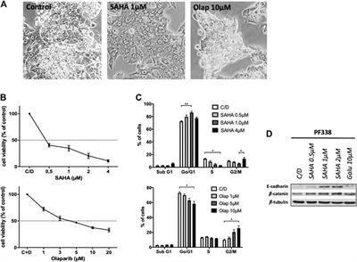 HDAC Inhibition Induces Cell Cycle Arrest and Mesenchymal-Epithelial Transition in a Novel Pleural-Effusion Derived Uterine Carcinosarcoma Cell Line